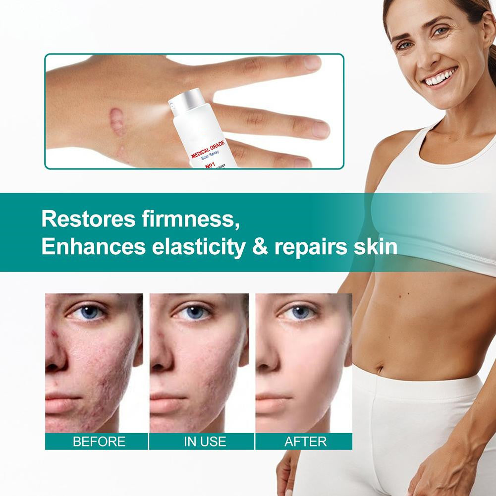Advance Scar Spray For All Types Of Scar