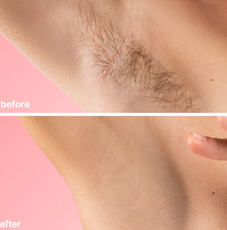 Bare Basics No Shave Hair Removal Cream