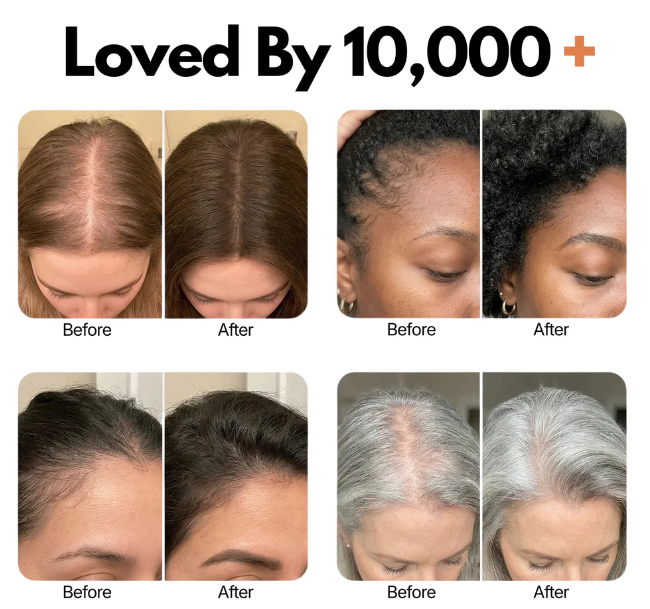 Korea's #1 Hair Grow Serum