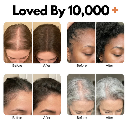 Korea's #1 Hair Grow Serum