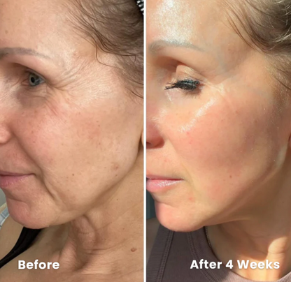Retinal Cream