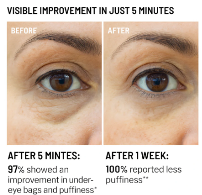 EYEUNDER™ Dark Circles & Bag Eye Cream