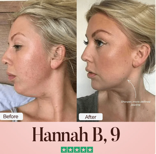 The cherieglow™ Lift : Infused with Retinol & Collagen to Reveal Your Best Jawline