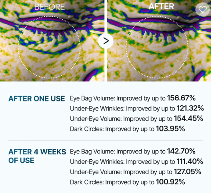 Eye Cream For Eyebags