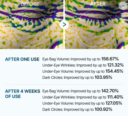 Eye Cream For Eyebags